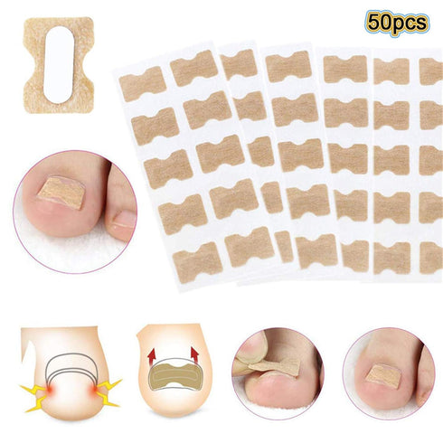 Ingrown Toenail Correction Patch, 50 Pcs Glue-free Ingrown Toenail Stickers Ingrown Curved Toenail Lifter Foot Care Stickers, Professional Ingrown Toenail Pedicure Tool for Keep Nail Healthy