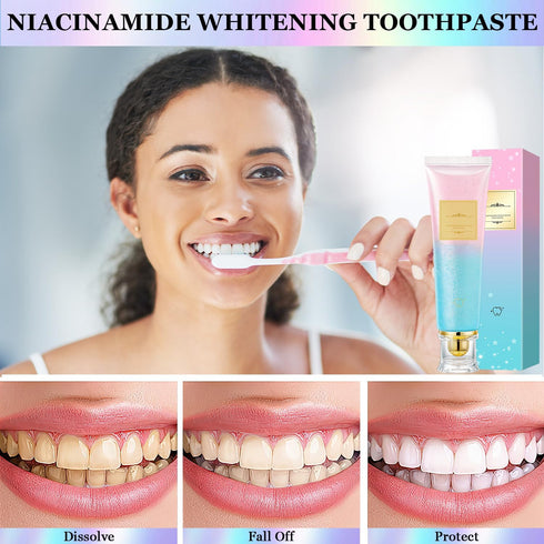 NIUYOU 2Pcs Acssart Radiant Whitening Toothpaste,Niacinamide Whitening Toothpaste,Easilyous Bright Whiteing