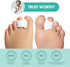 Hammer (3 6 Pack) Welnove Toe Separator for Overlapping Toes - Toe Spacers for Bunions - Toe Corrector for Toes