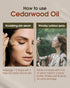 Cedarwood Essential Oil - 10 mL (1/3 oz) - Pure, Natural, Therapeutic Grade for Diffuser, Massage, Stress Relief
