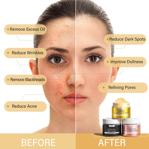 Turmeric Vitamin C Clay Mask, Dead Sea Mud Mask, and Himalayan Clay Mask, Facial Skin Care Set for Deep Pore Cleansing, Reduce Blackheads Acne, Dark Spots, Oil Control, and Radiant Skin