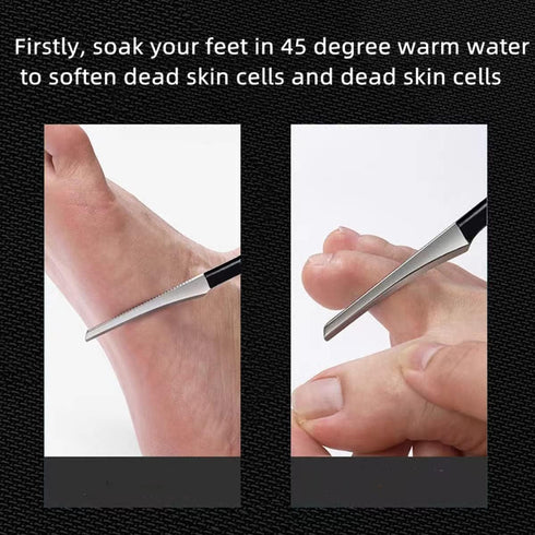 Professional Pedicure Knife Tools, Stainless Steel Foot Dead Skin Scraper,3Pcs Black Scrubber to Remove Dead Skin Callus Knife Scraping Pedicure Tools for Men Women