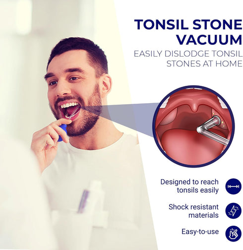 Oravix Tonsil Stone Vacuum, Tonsil Stone Removal Tool with Suction, Cupping Tool, Extractor for Tonsil Stones