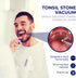Oravix Tonsil Stone Vacuum, Tonsil Stone Removal Tool with Suction, Cupping Tool, Extractor for Tonsil Stones