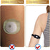 YouKnow Arm Band for Freestyle Libre 3, Adjustable 8-20" Armband Compatible with CGM Transmitter Protection Sensor Cover