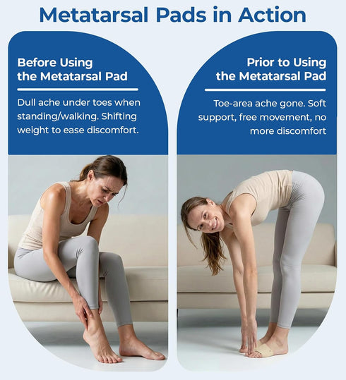 MasterMo 2 Metatarsal Pads for Men and Women - Ball of Foot Pain Relief Cushions for Sesamoiditis, Metatarsalgia