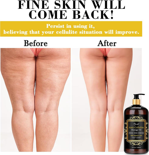 Pjordo Anti Cellulite Massage Oil with Massager, Collagen and Stem Cell Skin Tightening Oil Natural Cellulite Remover