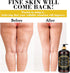 Pjordo Anti Cellulite Massage Oil with Massager, Collagen and Stem Cell Skin Tightening Oil Natural Cellulite Remover