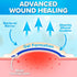 JJ CARE Hydrocolloid Dressing 4x4, Pack of 10, Self-Adhesive Thin Hydrocolloid Wound Dressing