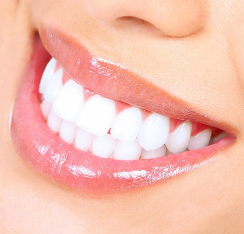 White Teeth Global 8 44% Teeth Whitening at Home Kit with Syringes Tooth Whitening Gel, Mouth Trays and a Tooth Shade