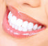 White Teeth Global 8 44% Teeth Whitening at Home Kit with Syringes Tooth Whitening Gel, Mouth Trays and a Tooth Shade