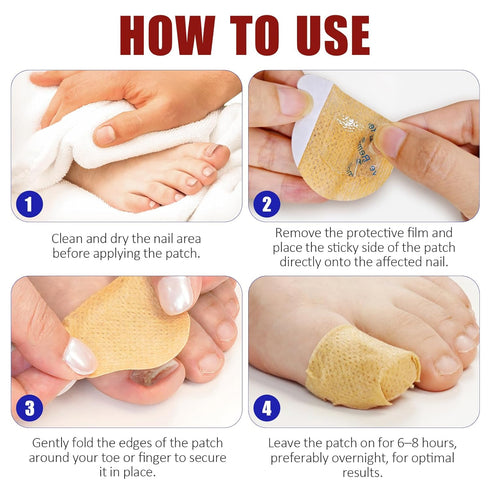 NIFEISHI (32pcs) Fungal Nail Patches for Toenails, Toenail Fungus Treatment Extra Strength for Overnight Toenail Care