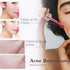 Peeling Solution AHA 30% + BHA 2% - Exfoliating Facial Serum Chemical Peel for Face, Reduces Blemishes and Fine Lines