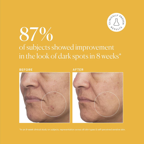 Naturium Tranexamic Topical Acid 5% - Face & Skin Care with Kojic Acid, Niacinamide & Licorice Root