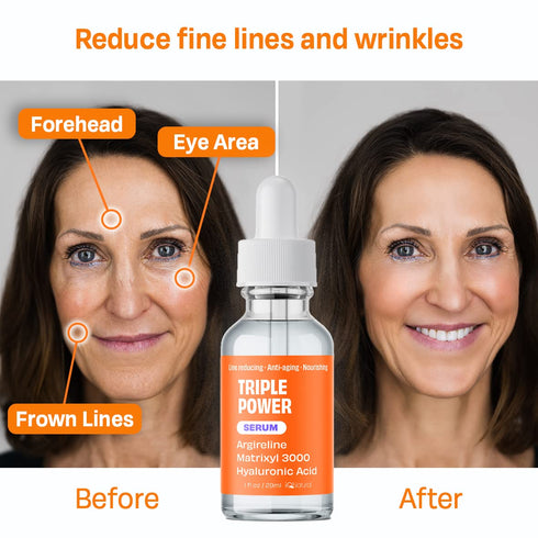 IQ Natural Argireline & Matrixyl 3000 Serum - Anti-Aging Peptide Serum for Face, Hydrating for Women and Men, 1oz.