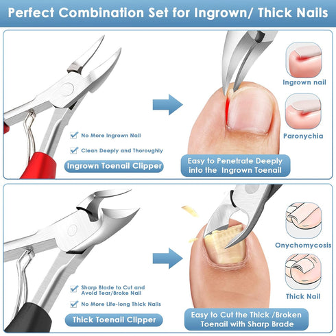 Modacraft 8 PCS Podiatrist Toenail Clippers, Professional Heavy Duty Ingrown & Thick Nail Clippers Kit