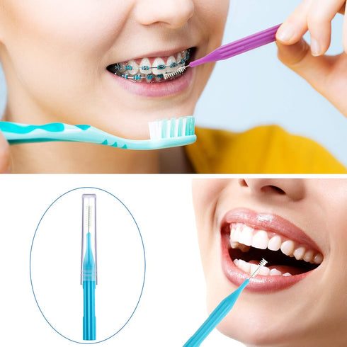 100 Pieces Braces Brush for Cleaner, Interdental Brush Toothpick Dental Flossing Tool