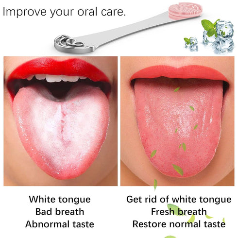 Tongue Scraper Cleaner, Bad Breath Treament&Get Rid of White Tongue, 100% BPA Free Medical Grade Stainless Steel Tongue Scrubber for Oral Care Dentist Recommendation
