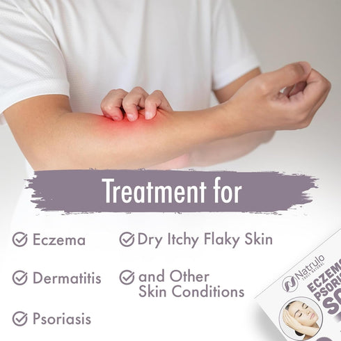 Eczema Soap Bar for Face and Body, All Natural Treatment for Dry Itchy Skin Relief