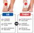 Gel Heel Pads for Shoes, Plantar Fasciitis Cups for Pain Relief, Silicone Cushions, Protector Insoles, 3 Pairs (S/M)