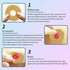 ovand 2 mm 10) Ostomy Barrier Rings - Ostomy Supplies - Thickness Moldable Ostomy Rings Medical Grade Hydrocolloid