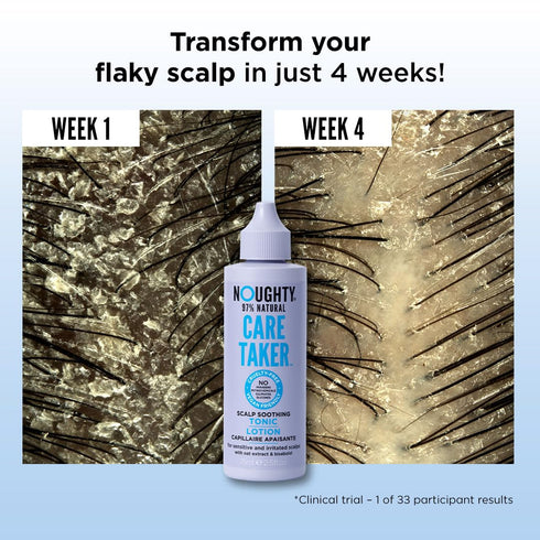 Noughty 97% Natural Care Taker Scalp Soothing Tonic | 75ml | Fragrance Free Leave-in Treatment for Sensitive Scalps