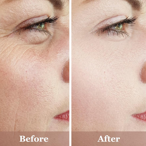 Anti-Aging Face Serum Trio, 20% Vitamin C, Hyaluronic Acid, 2.5% Retinol Serum - 3 Bottles x 1 Fl Oz | Brightening &
