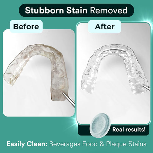 Retainer Cleaner Tablets, Invisalign Cleaner, Remove Stains, Odors & Plaque, Night Guard Cleaner, FSA & HSA Eligible, 4-Month Supply of PERSULFATE-FREE Denture Cleaner, 120 Tablets, Mint-Scented