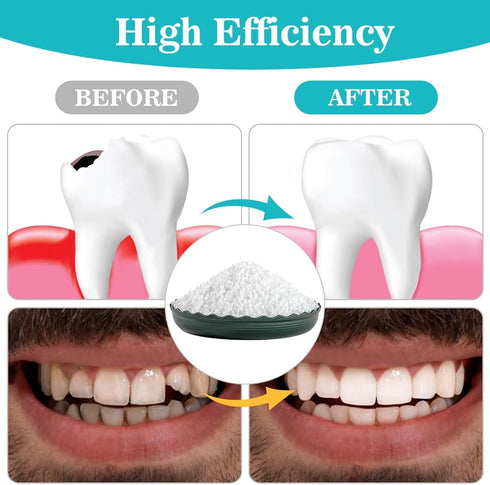 Sukh 10.9oz Repair Thermoplastic Beads, Moldable Plastic Pellets for Missing Tooth, DIY, Cosplay, Halloween Vampire