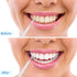 Patelai 50 Pieces Braces Brush for Cleaner Interdental Tooth Flossing Tool (Black, White, Gray)