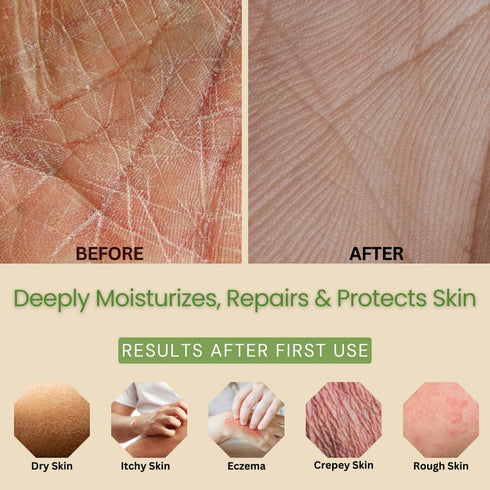 Moisturizing & Firming Lemongrass Body Lotion & Hand Cream, 8oz Natural Moisturizer for Dry Skin