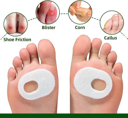 Welnove 84pcs Callus Pad with Water-Resistant Adhesive, Protects Foot, Heel and Toes from Rubbing, Pain Relief - White