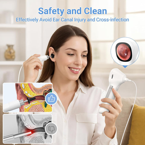 ScopeAround 1.45" 3.9mm 6 Otoscope with Light, IPS Display Digital Otoscope, Ear Camera with Ear Wax Removal Tools, Ear