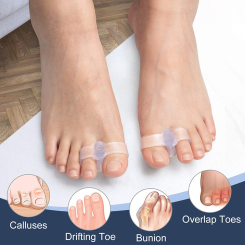 Gel Toe Corrector, 10 Pack of Toe Separators with 2 Loops, Big Toe Spacer for Bunion Pain and Overlapping Toe