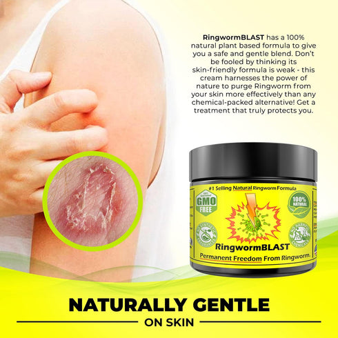 Ringworm Relief Fast Cream Ointment, Dermatologist Tested, Natural Extra Strength for Adults and Kids, No Chemicals