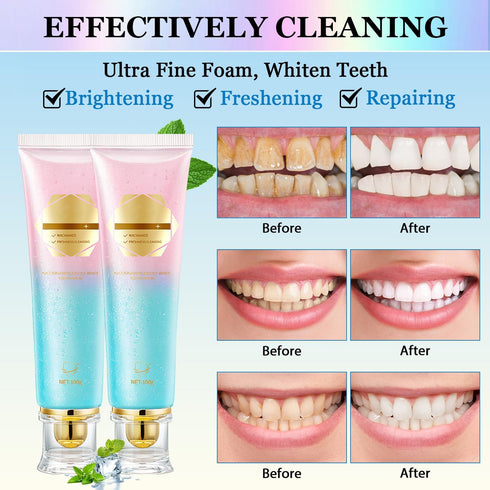 jioijioi 2Pcs Acssart Radiant Whitening Toothpaste,Unismart Toothpaste Whitening,Niacinamide Whiteing