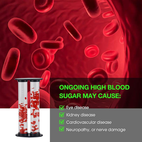 Healthy Blood Glucose & High Blood Glucose Vessel Models for Medical Doctor Teaching Diabetes Mellitus DM Patient