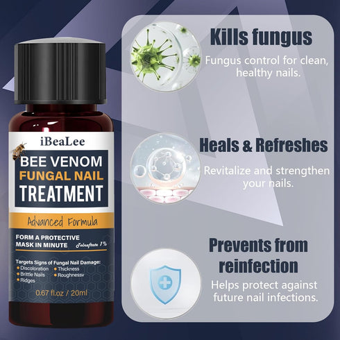 KISMIGER -1% 2 Toenail Fungus Treatment Extra Strength Tolnaftate, Bee Venom Nail Fungus Treatment, Gentle Fungal Nail