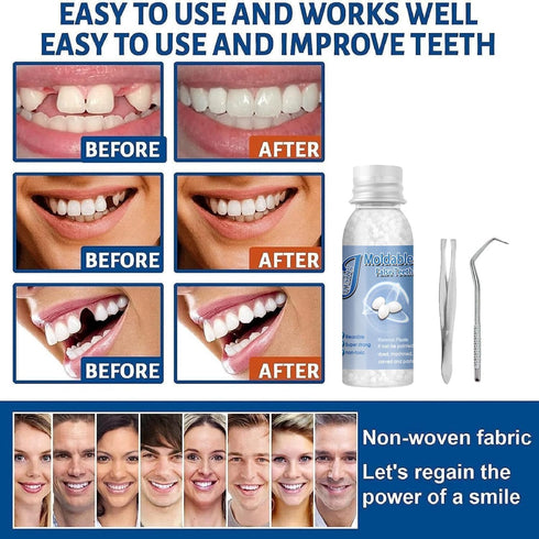 Tooth Repair Kits, 2Pcs 30ml Dental Repair Beads, 4Pcs Tools for Filling Missing Broken Tooth (2+4Pack)