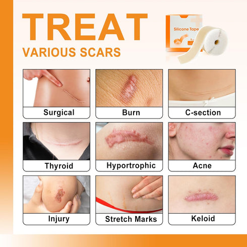 Silicone Scar Sheets, 1" x 60" Roll, Soft Silicone Tape for Scars Removal, Painless for Surgery, C-section, Burn