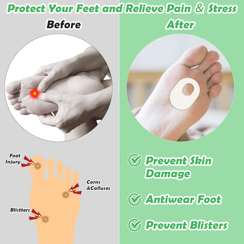 Shynek Callus Pads for Feet, 72 Pcs Soft Felt Self Adhesive Cushions for Men and Women, Pain Relief for Corns,
