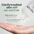 NOSCA9 Trouble Clear Toner S, Hydrating Exfoliating Toner for Sensitive Skin, Korean Skin Care (Pack of 1)