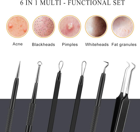 Pimple Popper Tool Kit - 6 Pcs Blackhead Remover Comedone Extractor Tool Kit with Metal Case for Quick Removal of