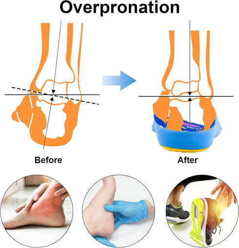 Kids Arch Support Orthotics Over-Pronation Plantar Fasciitis Flat Feet PU Foam Inserts Relieve Foot Back Hip Leg