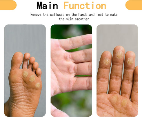 JLDGMXCDZ 3 (100/180/400), Callus Remover for Hands,Hands & Feet Callus File with Grit Sandpapers Durable Hand Callus
