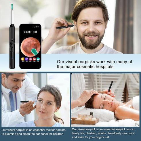 Ear Wax Removal Tool, Ear Cleaner with 1080P HD Otoscope Camera, Ear Cleaning Kit for iPhone and Android Phones