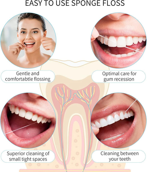 Easy-to-Use Sponge Floss - Cleaning of Implants and Bridges with Stiff Plastic Ends for Oral Hygiene