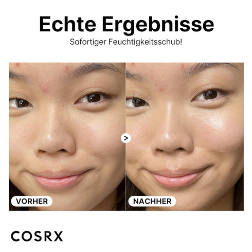 COSRX Pure Sodium Hyaluronic Acid 3% Serum, Hydration Boosting Facial Serum for Fine Lines (0.67fl.oz)