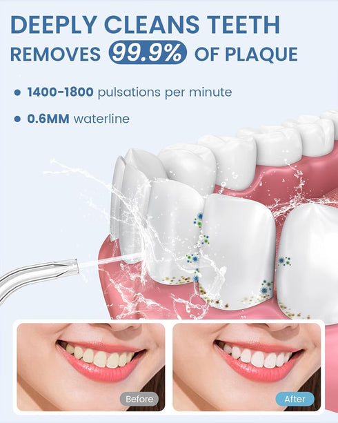 Water Flosser Teeth Pick: 9 Jet Tips Cordless Oral Irrigator with 300ML, 5 Modes Portable Power Dental Flossers, IPX7 Waterproof Rechargeable Electric Waterflosser Machine for Home Travel, Black