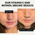 Eclat Skincare Face Serum Set - Vitamin C Serum for Radiance, Retinol Serum for Wrinkles
